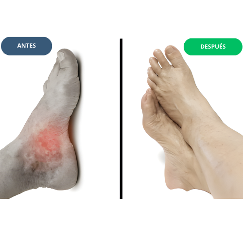 Masajeador de pies VitalFoot