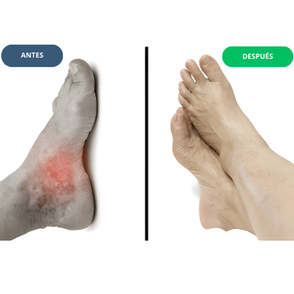 Masajeador de pies VitalFoot